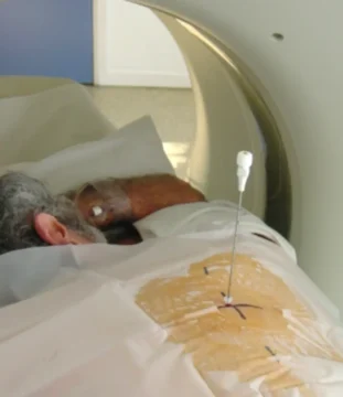 Ponction sous scanner vue ext