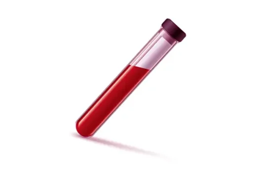 Certains biomarqueurs sanguins peuvent être prédictifs du développement du cancer du poumon.