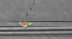 Biomarqueurs innovants tissulaires liquides et IA